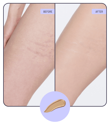 Body Coverage Perfector